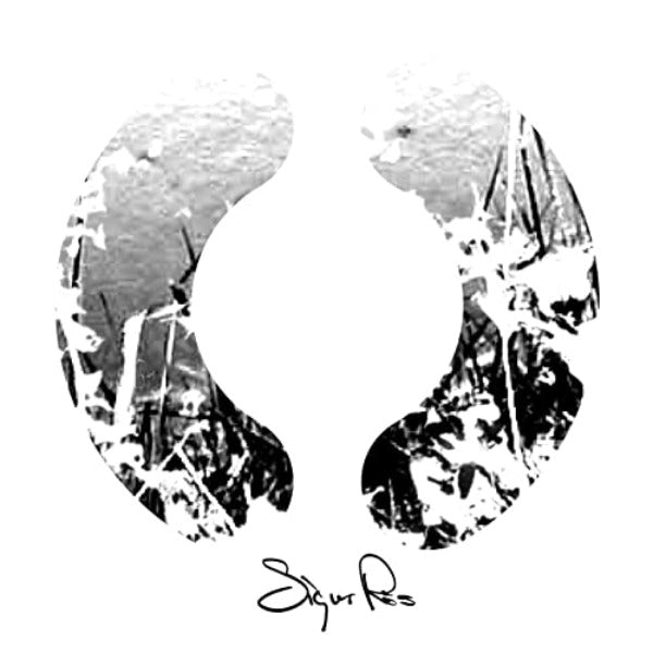 Sigur Ros // ()